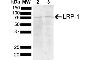 Western blot analysis of Mouse, Rat Brain showing detection of 504. (LRP1 Antikörper  (AA 160-260) (Atto 594))