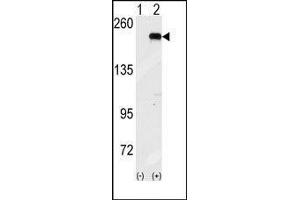 Western blot analysis of GCN2 (arrow) using GCN2 Antibody