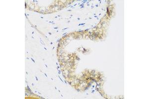 Immunohistochemistry of paraffin-embedded human prostate using KIAA1456 antibody at dilution of 1:200 (40x lens). (KIAA1456 Antikörper)