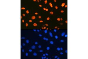 Immunofluorescence analysis of U-2 OS cells using Ku80 Rabbit mAb (ABIN7271406) at dilution of 1:100 (40x lens). (XRCC5 Antikörper)