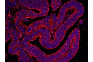 Immunohistochemistry (IHC) image for anti-Filamin B, beta (FLNB) (AA 2552-2602) antibody (ABIN7448565) (FLNB Antikörper  (AA 2552-2602))