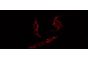 ABIN6274444 staining COLO205 cells by IF/ICC. (PARD3 Antikörper  (C-Term))