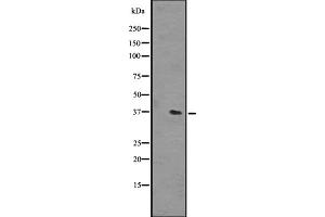 Western blot analysis of OR51L1 expression in NCI-H292 cell line lysates ,The lane on the left is treated with the antigen-specific peptide. (OR51L1 Antikörper  (Internal Region))