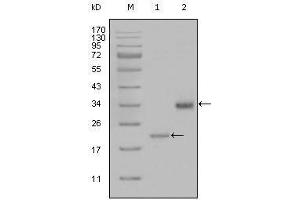 Western blot analysis using LPA mouse mAb against truncated LPA-His recombinant protein (1) and truncated Trx-LPA(aa4330-4521) recombinant protein (2). (LPA Antikörper)