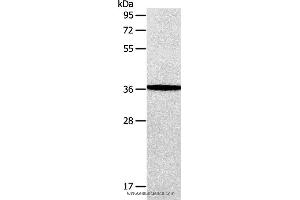 Western blot analysis of Human fetal brain tissue, using AASDHPPT Polyclonal Antibody at dilution of 1:650 (AASDHPPT Antikörper)