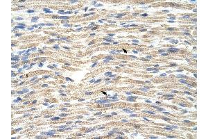 CARF antibody was used for immunohistochemistry at a concentration of 4-8 ug/ml to stain Skeletal muscle cells (arrows) in Human Muscle. (CDKN2AIP Antikörper  (C-Term))