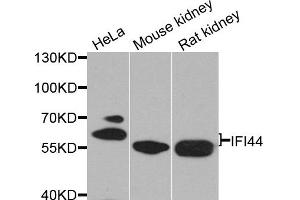 Western blot analysis of extracts of various cell lines, using IFI44 antibody. (IFI44 Antikörper)