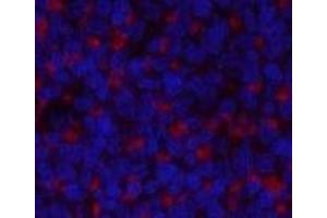 Immunofluorescence analysis of Rat spleen tissue using JAK2 Polyclonal Antibody at dilution of 1:200. (JAK2 Antikörper)