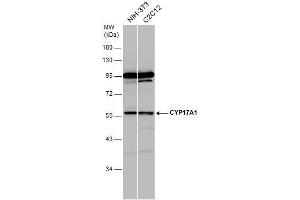 WB Image Various whole cell extracts (30 μg) were separated by 10% SDS-PAGE, and the membrane was blotted with CYP17A1 antibody [N1C2] , diluted at 1:1000. (CYP17A1 Antikörper  (Center))