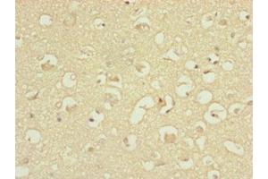 Immunohistochemistry of paraffin-embedded human brain tissue using ABIN7144845 at dilution of 1:100 (ATP5H Antikörper  (AA 1-161))