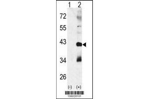 Western blot analysis of CTDSP1 using rabbit polyclonal p38 beta Antibody using 293 cell lysates (2 ug/lane) either nontransfected (Lane 1) or transiently transfected with the CTDSP1 gene (Lane 2). (MAPK11 Antikörper  (AA 133-161))