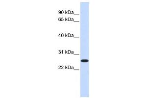 Western Blotting (WB) image for anti-CTD Nuclear Envelope Phosphatase 1a (CTDNEP1A) antibody (ABIN2459072) (CTDNEP1A Antikörper)