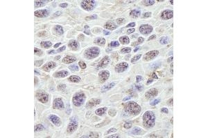 Immunohistochemistry (IHC) image for anti-Guanine Nucleotide Binding Protein-Like 3 (Nucleolar) (GNL3) (C-Term) antibody (ABIN7448582)