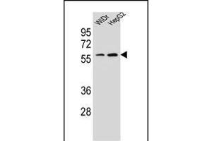 HOXA10 Antibody (Center) (ABIN654234 and ABIN2844067) western blot analysis in WiDr,HepG2 cell line lysates (35 μg/lane). (HOXA10 Antikörper  (AA 244-271))