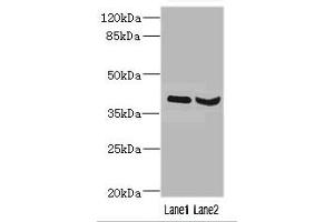 Western blot All lanes: HOXD10 antibody at 3. (HOXD1 Antikörper  (AA 1-240))