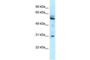 Image no. 1 for anti-Lymphoid-Restricted Membrane Protein (LRMP) (AA 354-403) antibody (ABIN6747836) (LRMP Antikörper  (AA 354-403))