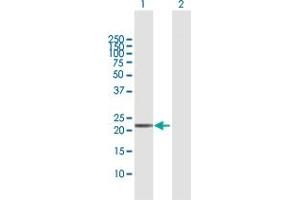 Western Blot analysis of TXNDC9 expression in transfected 293T cell line by TXNDC9 MaxPab polyclonal antibody. (TXNDC9 Antikörper  (AA 1-188))