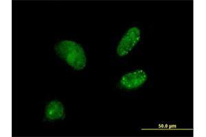 Immunofluorescence of purified MaxPab antibody to DCTN3 on HeLa cell. (DCTN3 Antikörper  (AA 1-176))