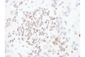 Immunohistochemistry (IHC) image for anti-Lamin A/C (LMNA) (AA 1-50) antibody (ABIN7455218)