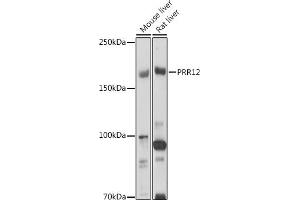 Western blot analysis of extracts of various cell lines, using PRR12 antibody (ABIN7269553) at 1:1000 dilution.
