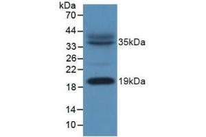 Western Blotting (WB) image for anti-NADH Dehydrogenase (Ubiquinone) 1, alpha/beta Subcomplex, 1, 8kDa (NDUFAB1) (AA 5-129) antibody (ABIN7439897)
