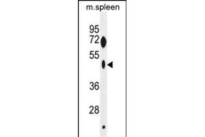 ZNF385C Antibody (N-term) (ABIN655429 and ABIN2844966) western blot analysis in mouse spleen tissue lysates (35 μg/lane). (ZNF385C Antikörper  (N-Term))