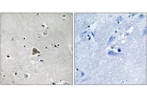 Immunohistochemistry analysis of paraffin-embedded human brain tissue, using Claudin 4 (Ab-208) Antibody. (Claudin 4 Antikörper  (AA 160-209))