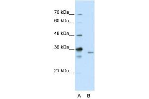 EXOSC3 antibody used at 2. (EXOSC3 Antikörper  (C-Term))