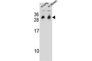 Western blot analysis in mouse lung/spleen tissue lysates (35ug/lane) using CYB561D1 Antibody . (CYB561D1 Antikörper  (C-Term))