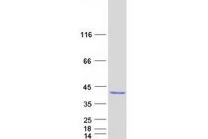 Western Blotting (WB) image for Exosome Component 8 (EXOSC8) protein (Myc-DYKDDDDK Tag) (ABIN2720635)