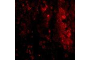 Immunofluorescence of IL-33 in human lymph node tissue with AP30426PU-N IL-33 antibody at 20 μg/ml. (IL-33 Antikörper  (N-Term))