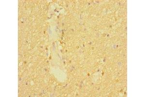 Immunohistochemistry of paraffin-embedded human brain tissue using ABIN7170007 at dilution of 1:100 (SLC6A7 Antikörper  (AA 557-636))