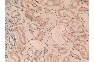 IHC-P analysis of Human Kidney Tissue, with DAB staining. (C1QA Antikörper  (AA 28-245))