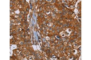 Immunohistochemistry (IHC) image for anti-Plectin (PLEC) antibody (ABIN2433604) (PLEC Antikörper)