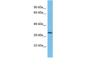 Host: Rabbit Target Name: TMEM202 Sample Type: HepG2 Whole Cell lysates Antibody Dilution: 1. (TMEM202 Antikörper  (C-Term))