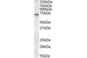 Image no. 1 for anti-Acetylcholinesterase (AChE) (C-Term) antibody (ABIN374526) (Acetylcholinesterase Antikörper  (C-Term))