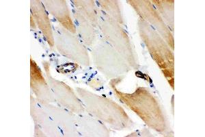 Anti-IRS1 antibody, (ABIN3043251), IHC(P)IHC(P): Rat Skeletal Muscle Tissue (IRS1 Antikörper  (AA 1041-1242))