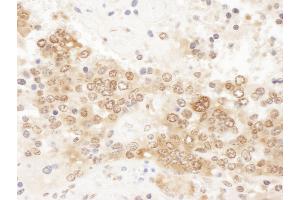 Immunohistochemistry (IHC) image for anti-Chloride Channel, Nucleotide-Sensitive, 1A (CLNS1A) (AA 187-237) antibody (ABIN7455042) (CLNS1A Antikörper  (AA 187-237))