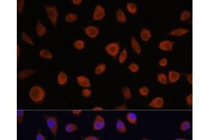 Immunofluorescence analysis of L929 cells using ZCCHC3 Polyclonal Antibody at dilution of 1:100. (ZCCHC3 Antikörper)