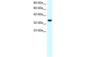 Western Blotting (WB) image for anti-Forkhead Box F1 (FOXF1) antibody (ABIN2460416) (FOXF1 Antikörper)