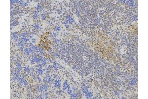 ABIN6275021 at 1/100 staining Human lymph node tissue by IHC-P. (ST6GAL1 Antikörper  (Internal Region))