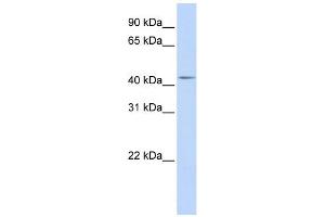 WB Suggested Anti-DENND1B Antibody Titration: 0. (DENND1B Antikörper  (Middle Region))