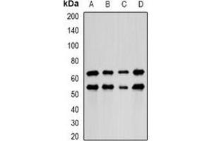 Western blot analysis of LIM expression in HepG2 (A), MCF7 (B), mouse lung (C), mouse kidney (D) whole cell lysates. (PDLIM5 Antikörper)