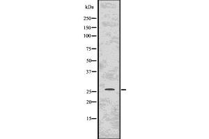 Western blot analysis of PPP1R1A using COS7 whole  lysates. (PPP1R1A Antikörper)