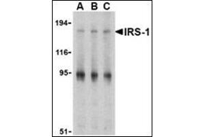 Western blot analysis of IRS-1 in PC-3 cell lysate with this product at (A) 1, (B) 2 and (C) 4 μg/ml. (IRS1 Antikörper  (Center))