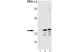 Western blot analysis of MnSOD pAb: Lane 1: HeLa Cell Lysate, Lane 2: Rat Brain Tissue Extract, Lane 3: Mouse Brain Tissue Extract (SOD2 Antikörper)