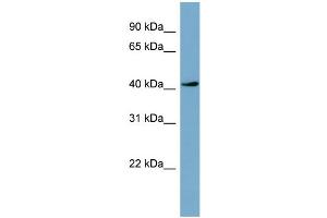 WB Suggested Anti-TSSK2  Antibody Titration: 0. (TSSK2 Antikörper  (Middle Region))