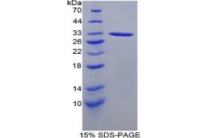 SDS-PAGE analysis of Mouse ACP5 Protein. (ACP5 Protein)