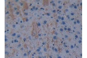 Detection of GSTt1 in Mouse Cerebrum Tissue using Polyclonal Antibody to Glutathione S Transferase Theta 1 (GSTt1) (GSTT1 Antikörper  (AA 7-240))