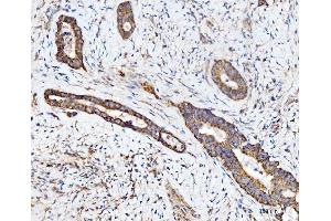 IHC analysis of ECSIT using anti-ECSIT antibody (ABIN7602543). (ECSIT Antikörper  (AA 83-339))